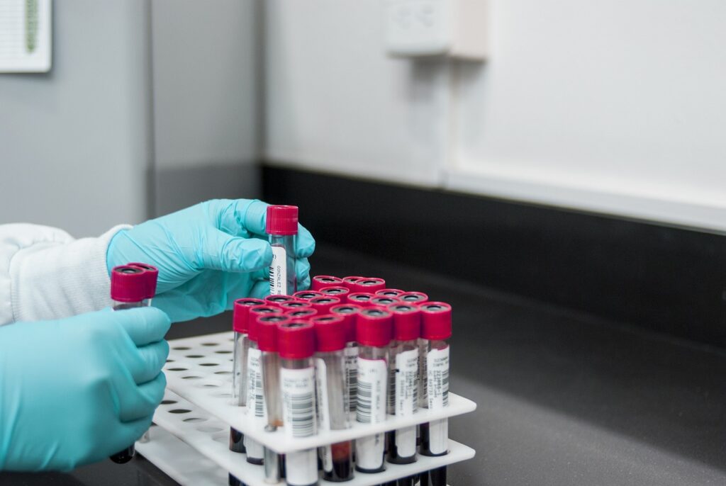 laboratóriumi-lelet-értelmezése_pic3